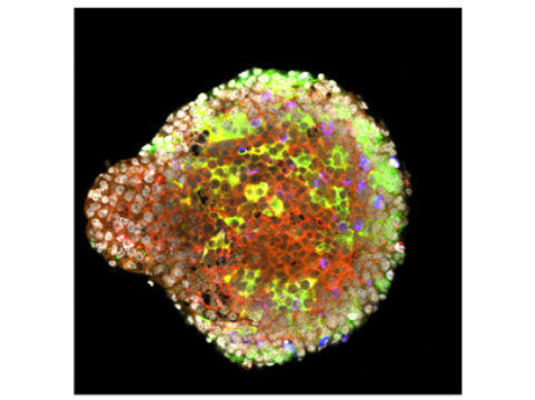 pancreatic islet langerhans