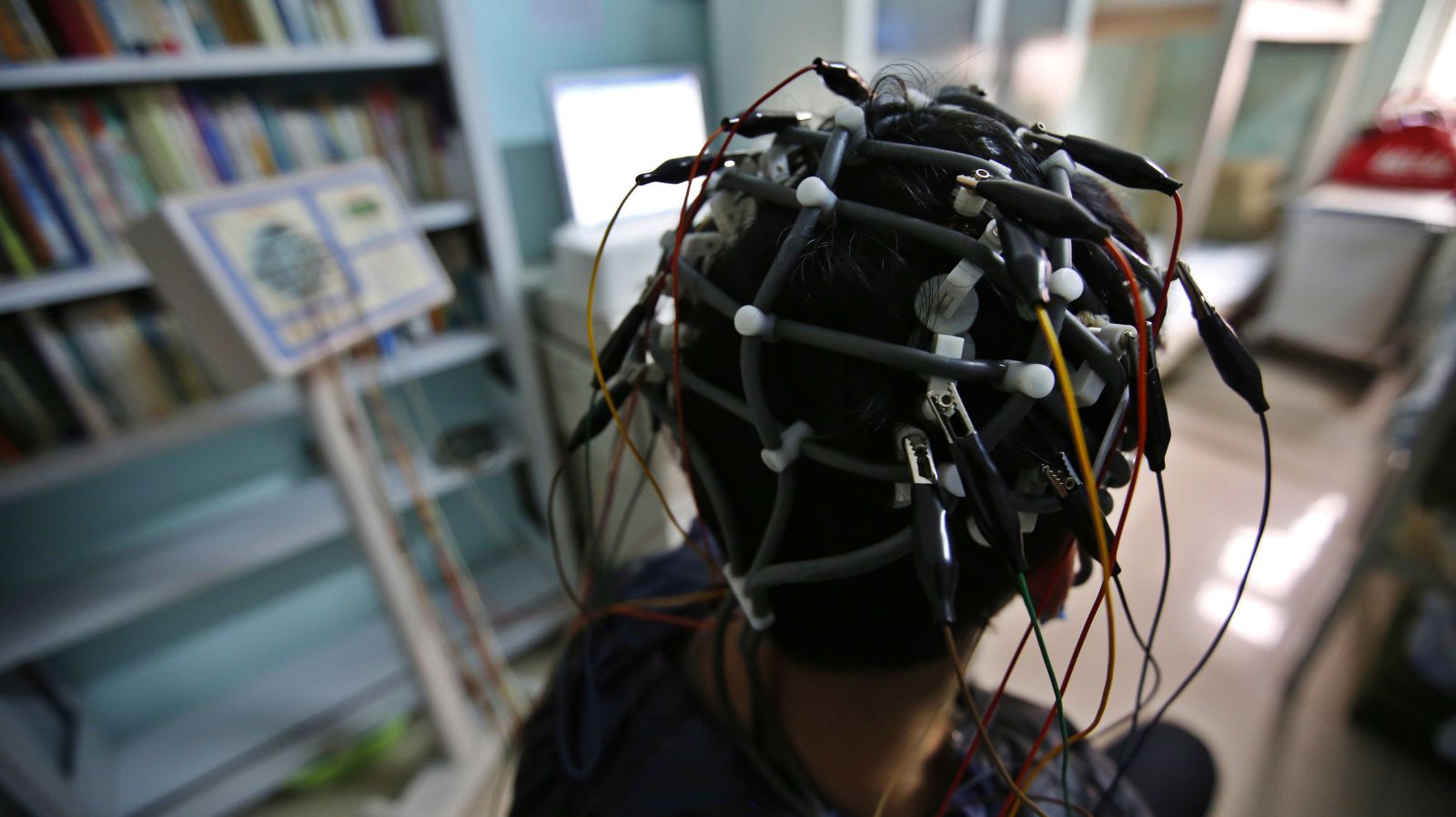 brain MRI
