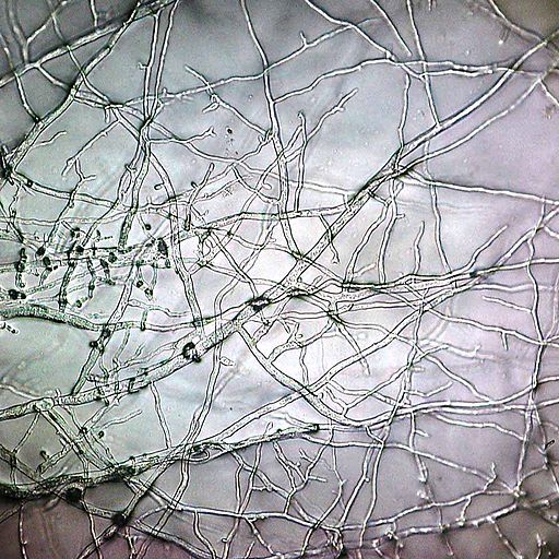 mold
