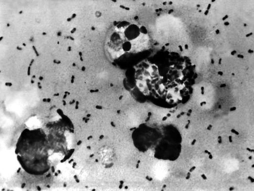 Click to enlarge yersinia pestic, plague