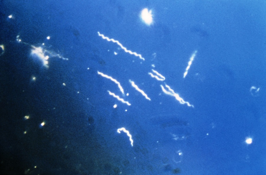Click to enlarge Borrelia burgdorferi
