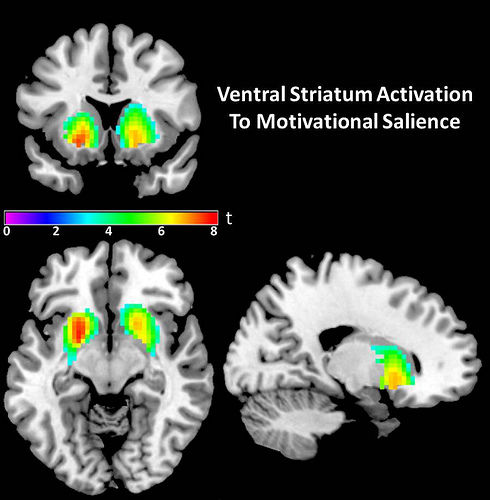 Click to enlarge ventral striatum reward center