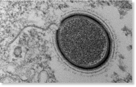 Virus
