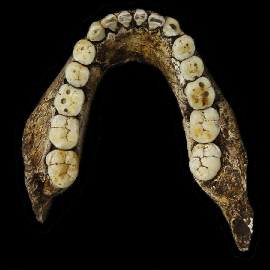 Mandible occlusal