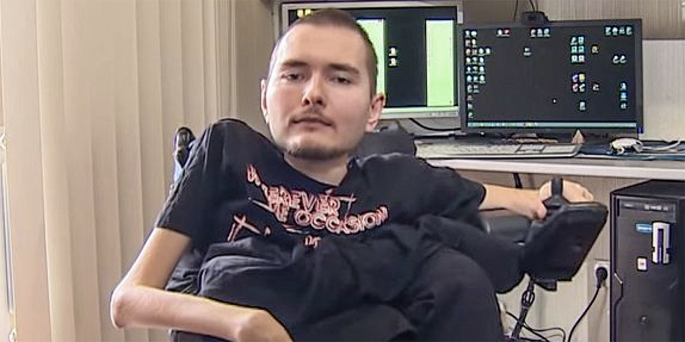 Click to enlarge Head transplant