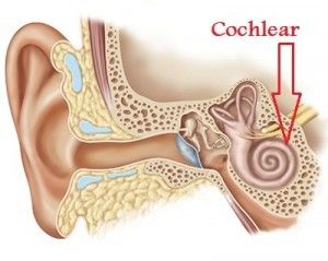 cochlear