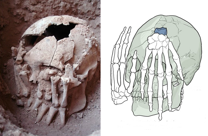 Decapitated Ancient Skull