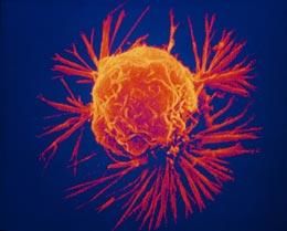 Click to enlarge cancer cells