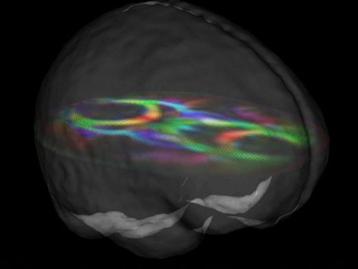 intellgent brains