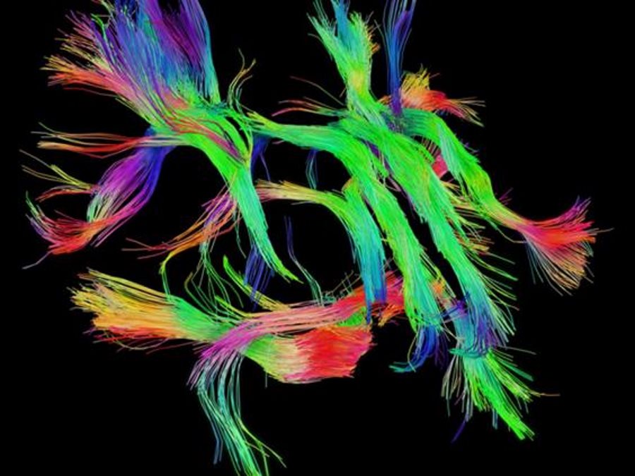 Click to enlarge white matter connectivity brain