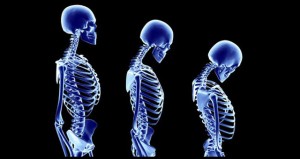 skeletons