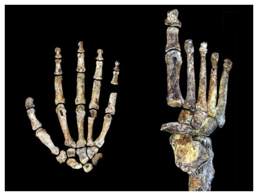 Click to enlarge Human Hand