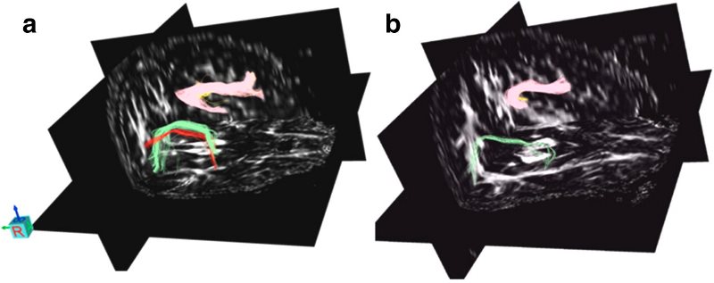 Click to enlarge music and brain