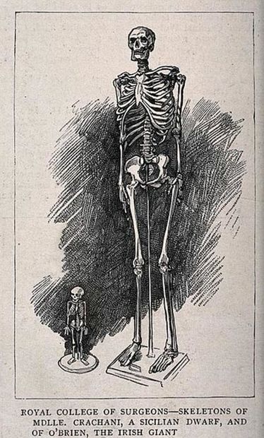 skeleton giant
