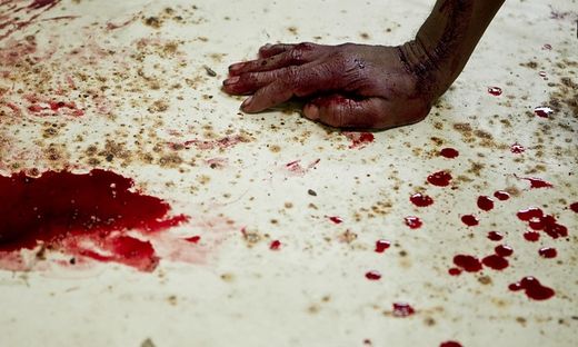 migrant injured central america