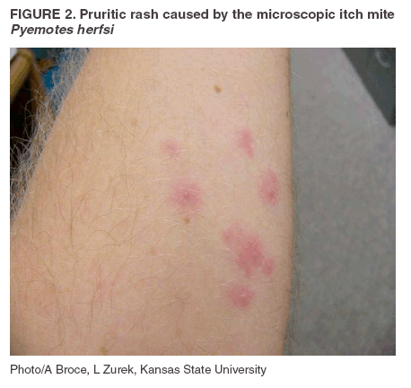 oak leaf itch mites