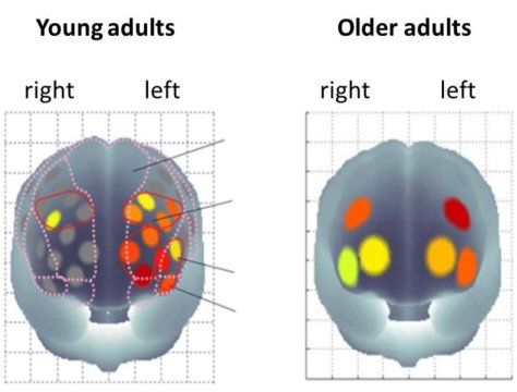 brain activation