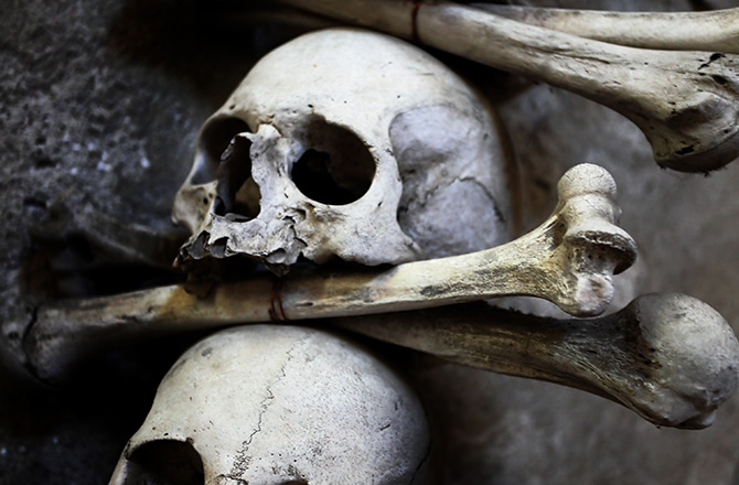 Click to enlarge human skull and bones