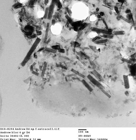 Click to enlarge carbon nanotubes in lungs