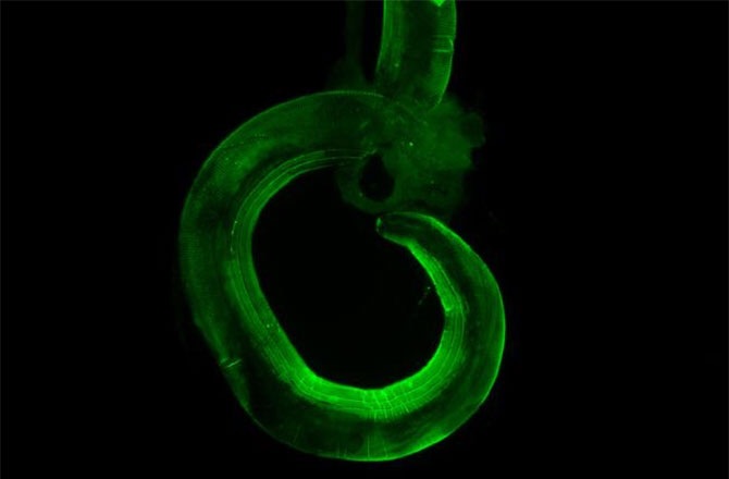 helminth intestinal worm