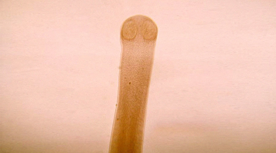 tapeworm