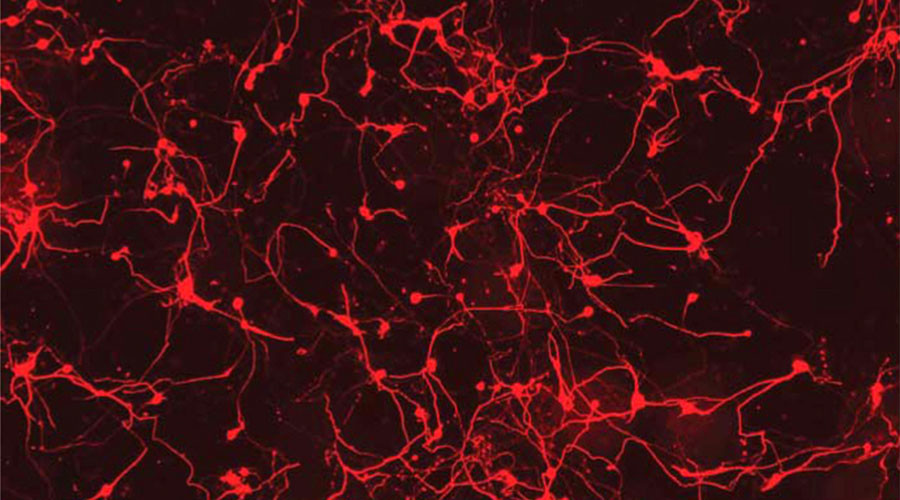 brain neurons