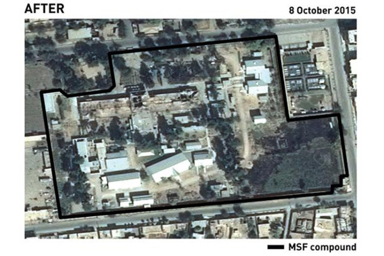 doctors without borders hospital