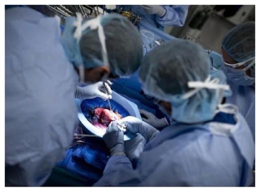 Click to enlarge Organ Transplant