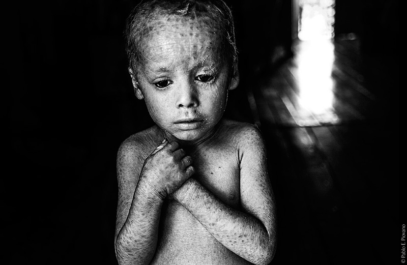Click to enlarge crystal boy Lucas Techeira glyphosate