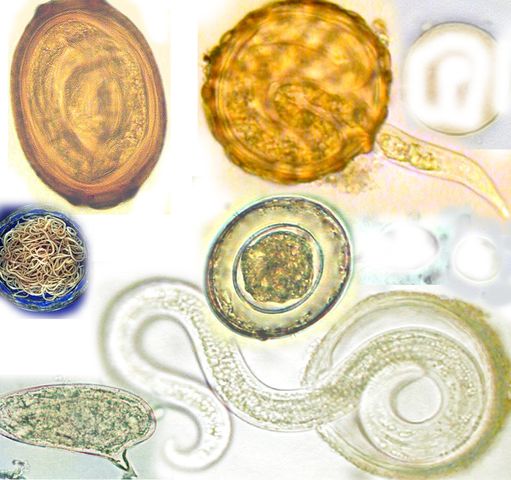 Click to enlarge parasites, helminth eggs