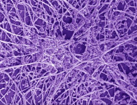 candida albicans