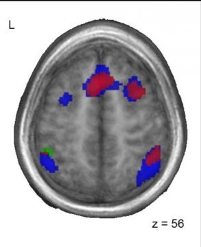 brain image