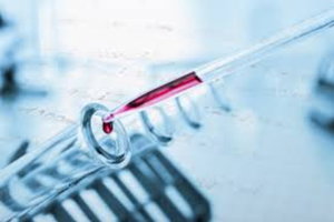 diagnostic tests