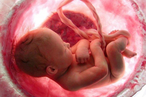 Fetus