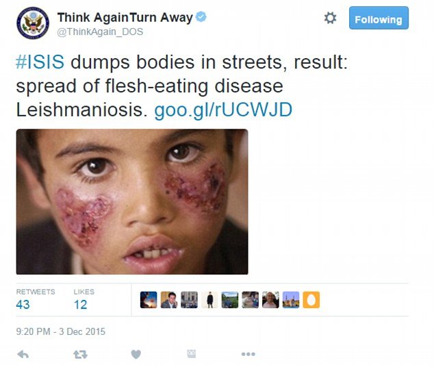 Click to enlarge twitter capture syrian boy flesh eating disease