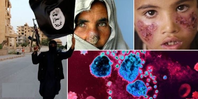 Syria flesh eating disease 