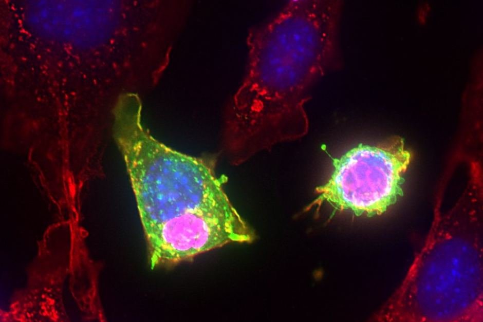 Toxoplasma parasite