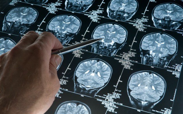 brain scan