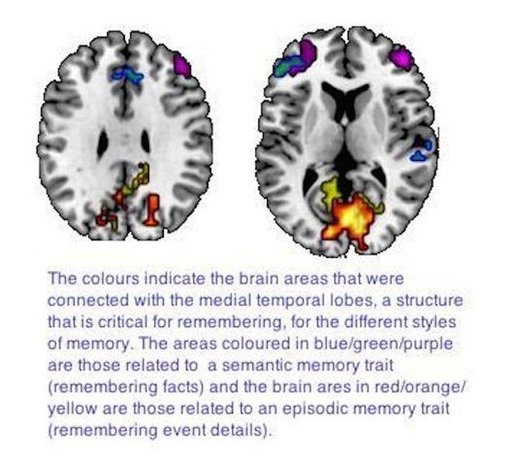 brain slices memory traits