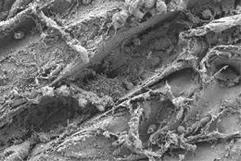 Click to enlarge Microrganisms garbage