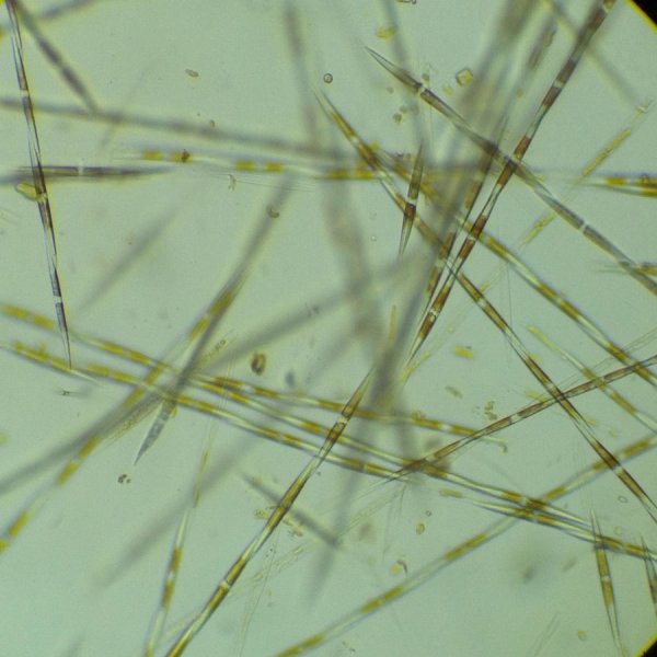 Click to enlarge domoic acid, toxic algae