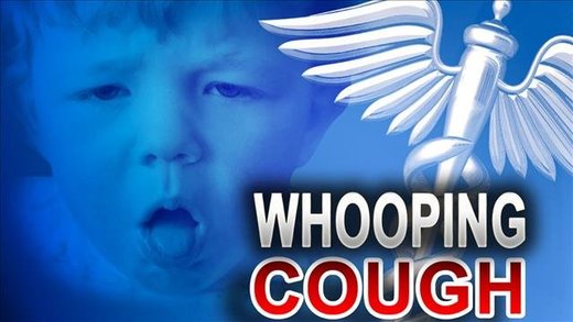 whooping cough