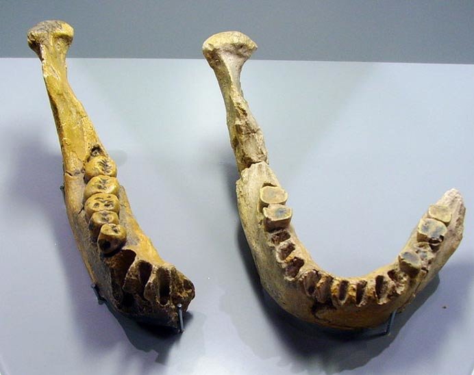 Lower jaw bone