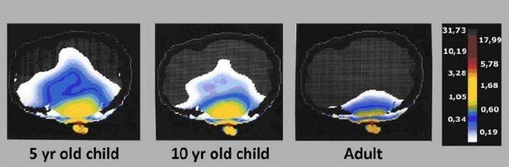 chart EMF child brain
