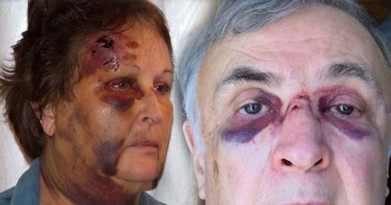 Carol and Richard LaDue, police brutality