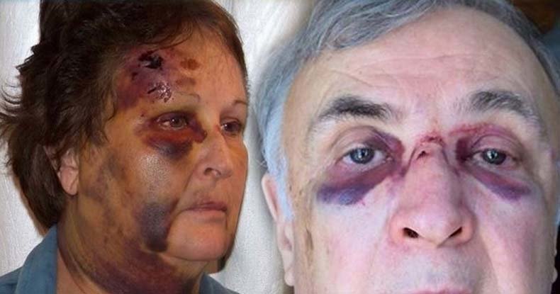 Carol and Richard LaDue, police brutality
