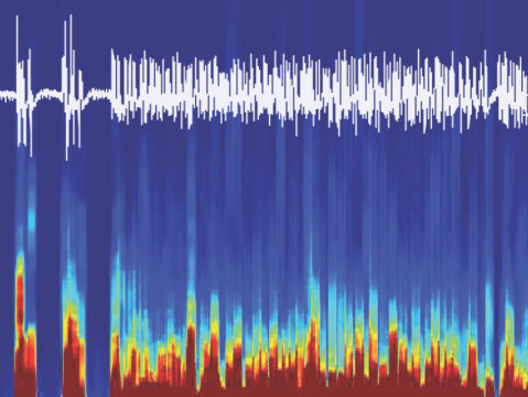 EEG brain recordings