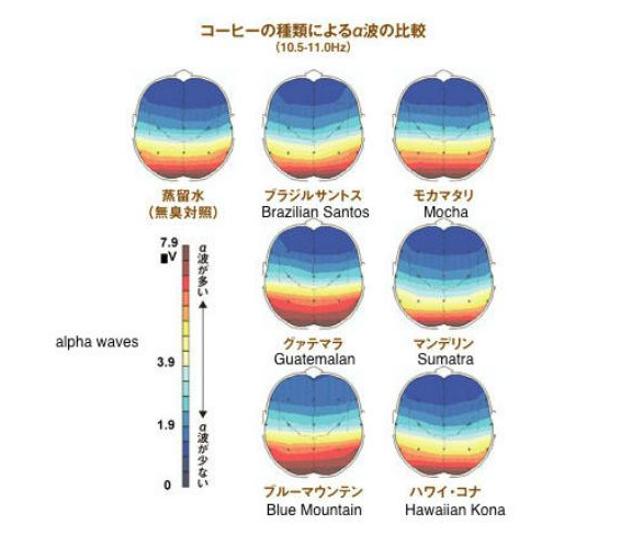 Click to enlarge Brain scans
