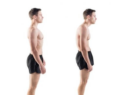 bad posture