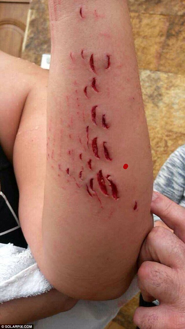 Click to enlarge Shark injuries